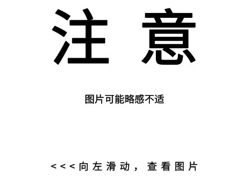 恩卓中盈 警惕！带状疱疹也会“全身窜”，这些人最危险
